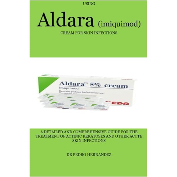 aldara comment acheter