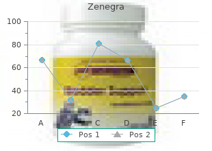 Ordre zenegra