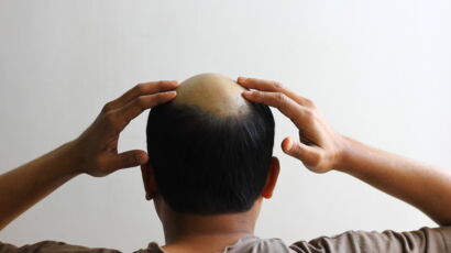 Finasteride biorga online
