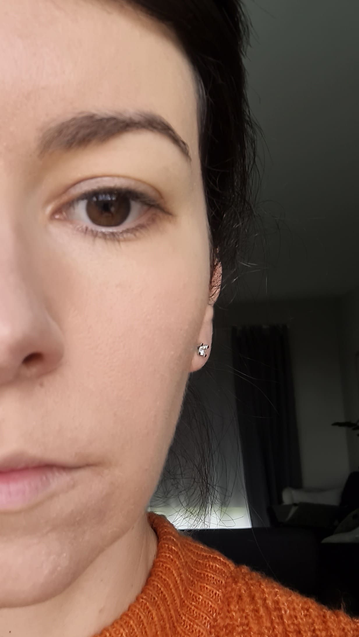 Pilule apres roaccutane