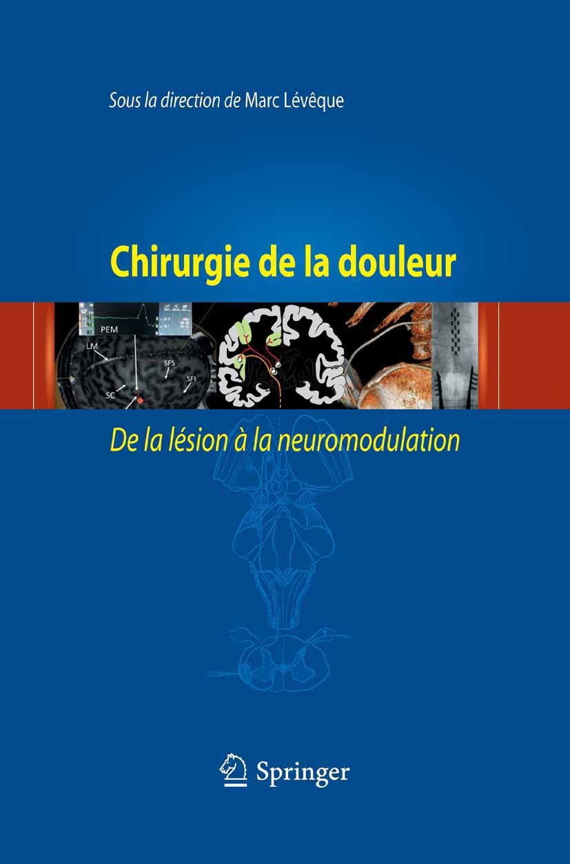 Baclofène online