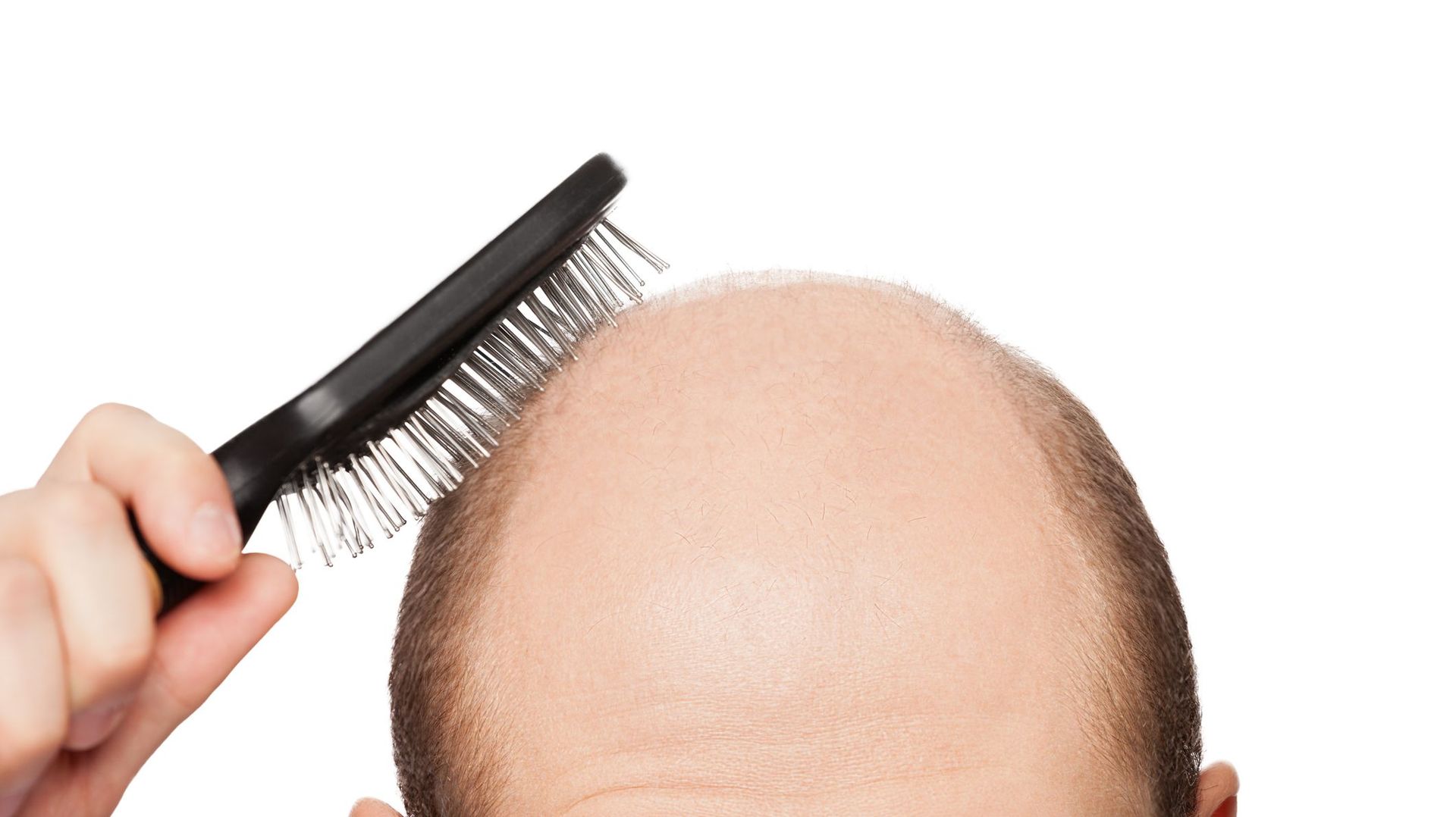 Finasteride 5mg Prix