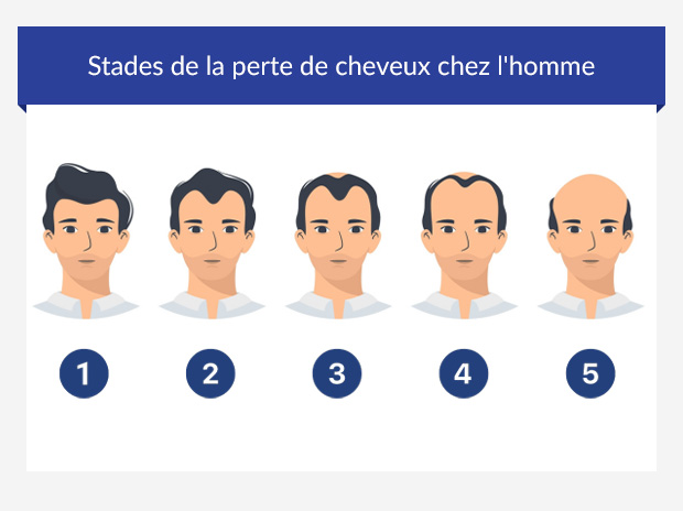 propecia acheter sans ordonnance