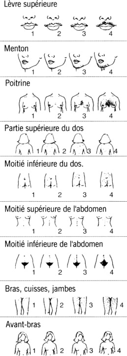Glucophage Bon Marché