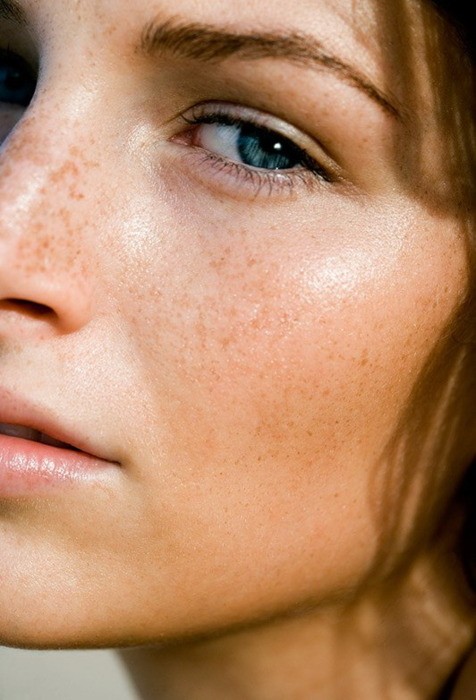 Pilule Apres Roaccutane