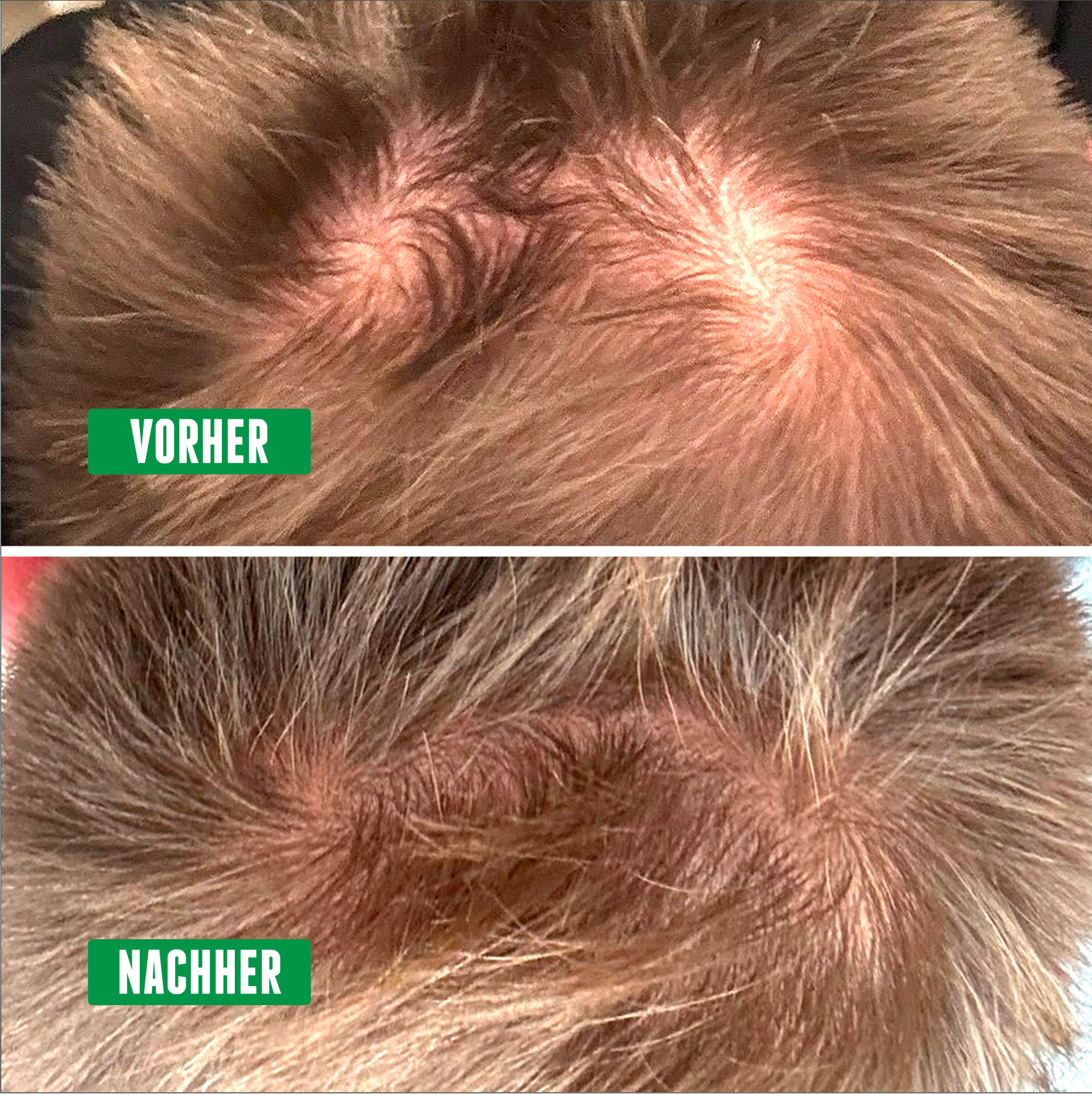 Finasteride online france