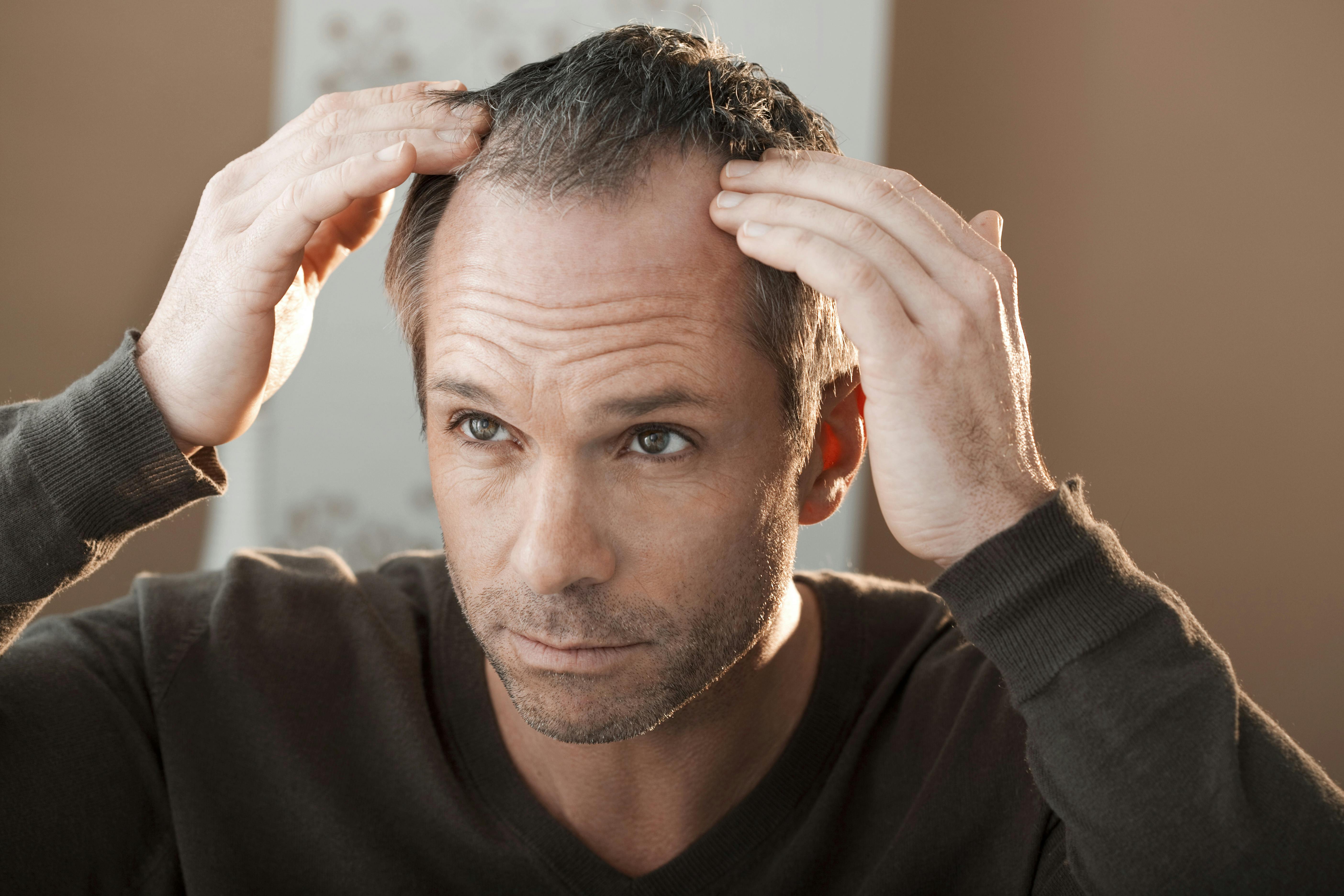 Finasteride Pilules