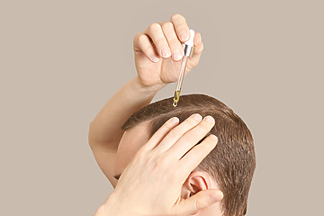 Finasteride Gel Online