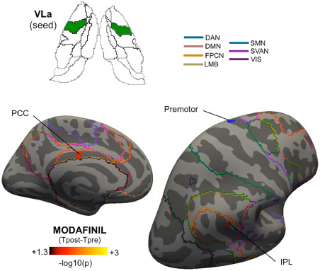 Commander modafinil