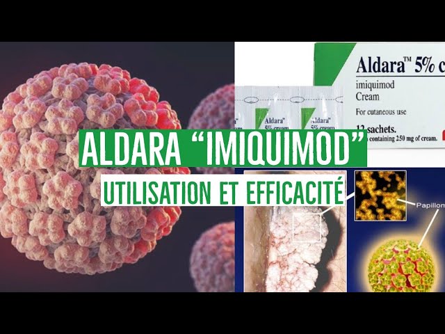 Aldara Sachet Prix