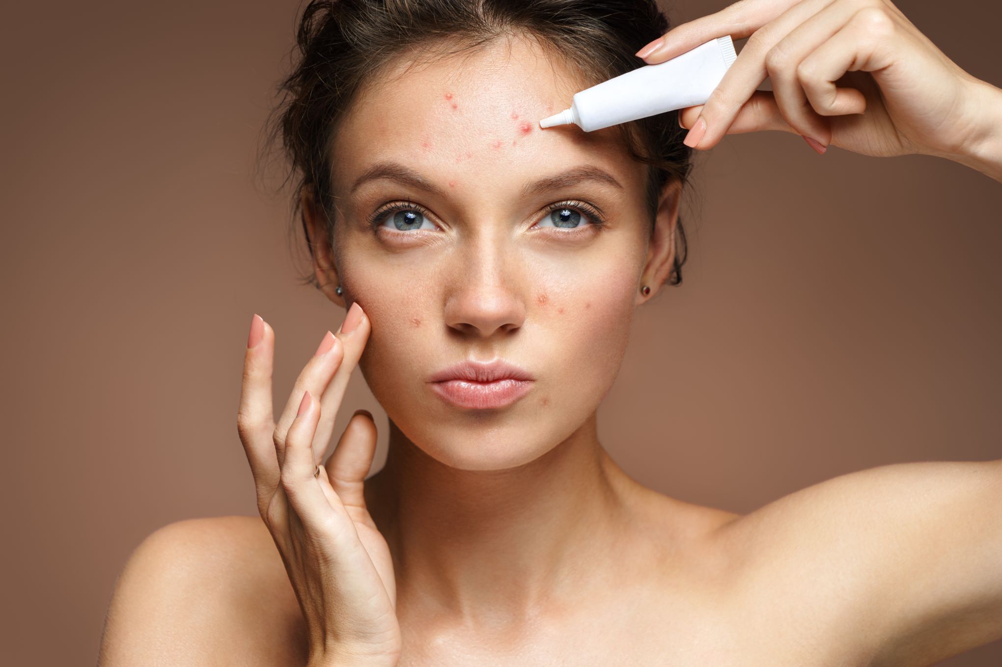 Acheter Roaccutane Comprimé