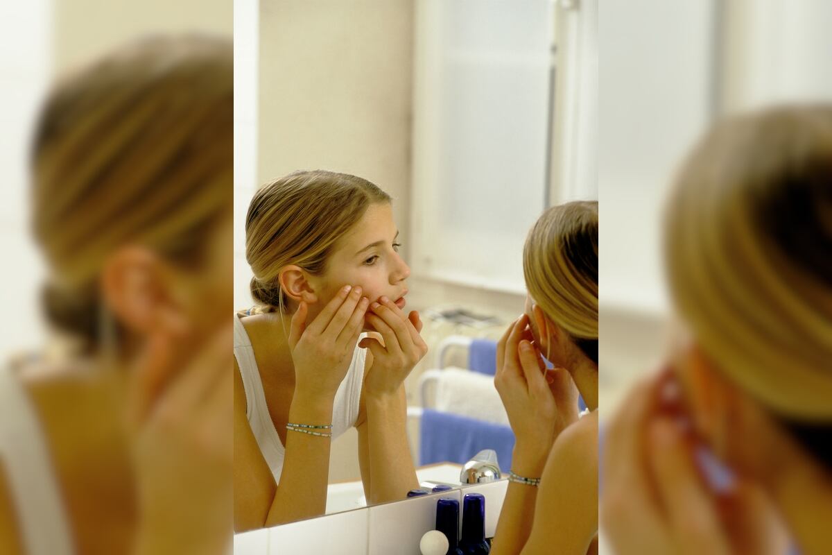Roaccutane bon marché