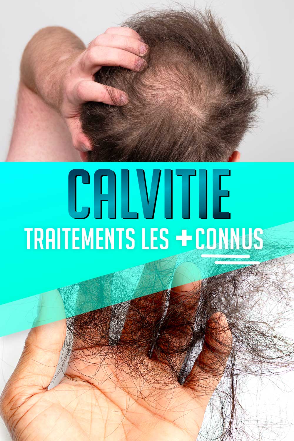 finasteride en france