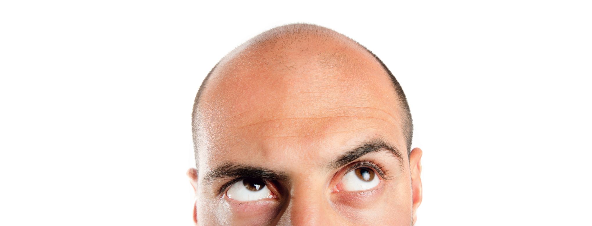 Finasteride gel prix