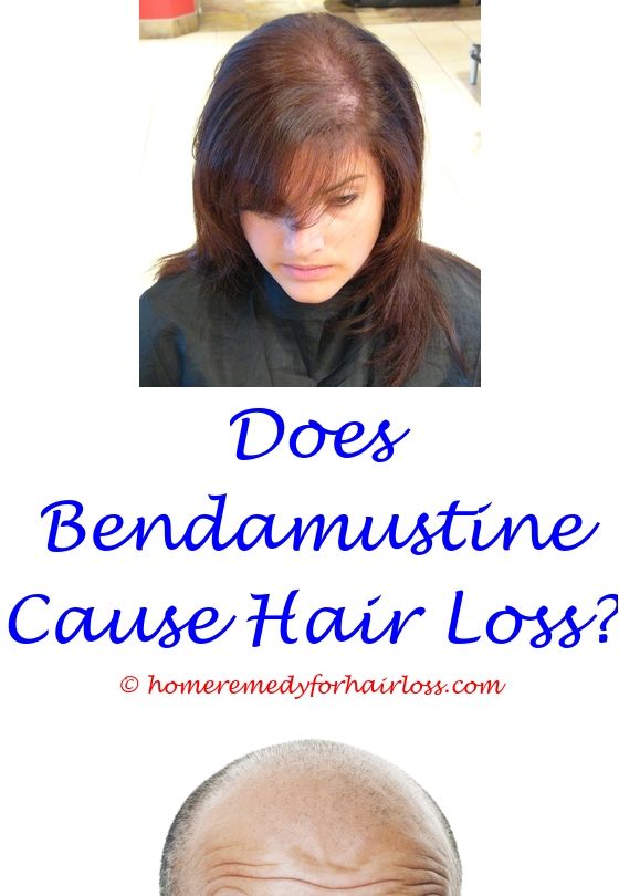 finasteride online italia