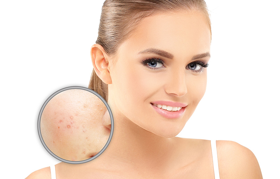 Prix Traitement Roaccutane