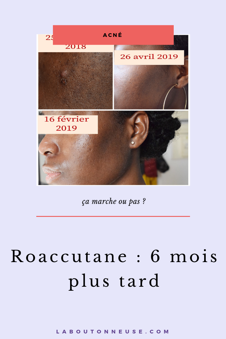 comment acheter du roaccutane