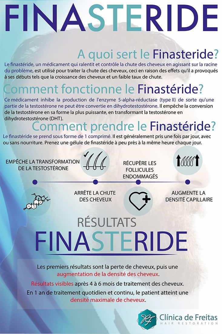 Finastéride 5 mg prix