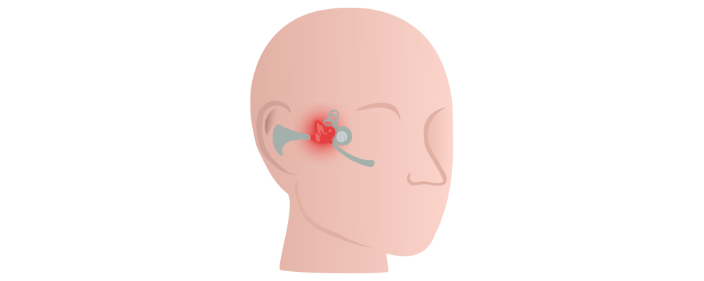 Amoxicilline Otite Sans Ordonnance