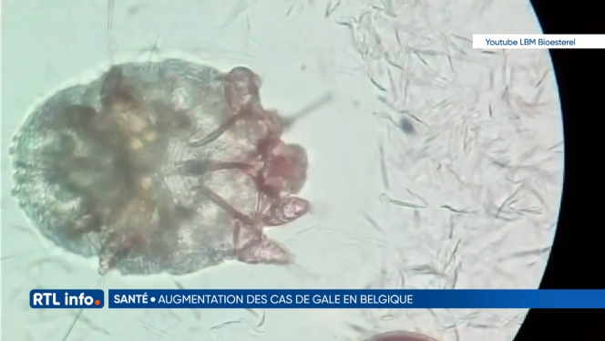 Ivermectine gale prix