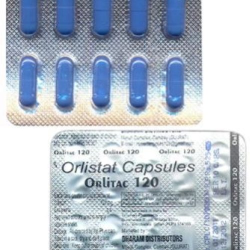 orlistat france