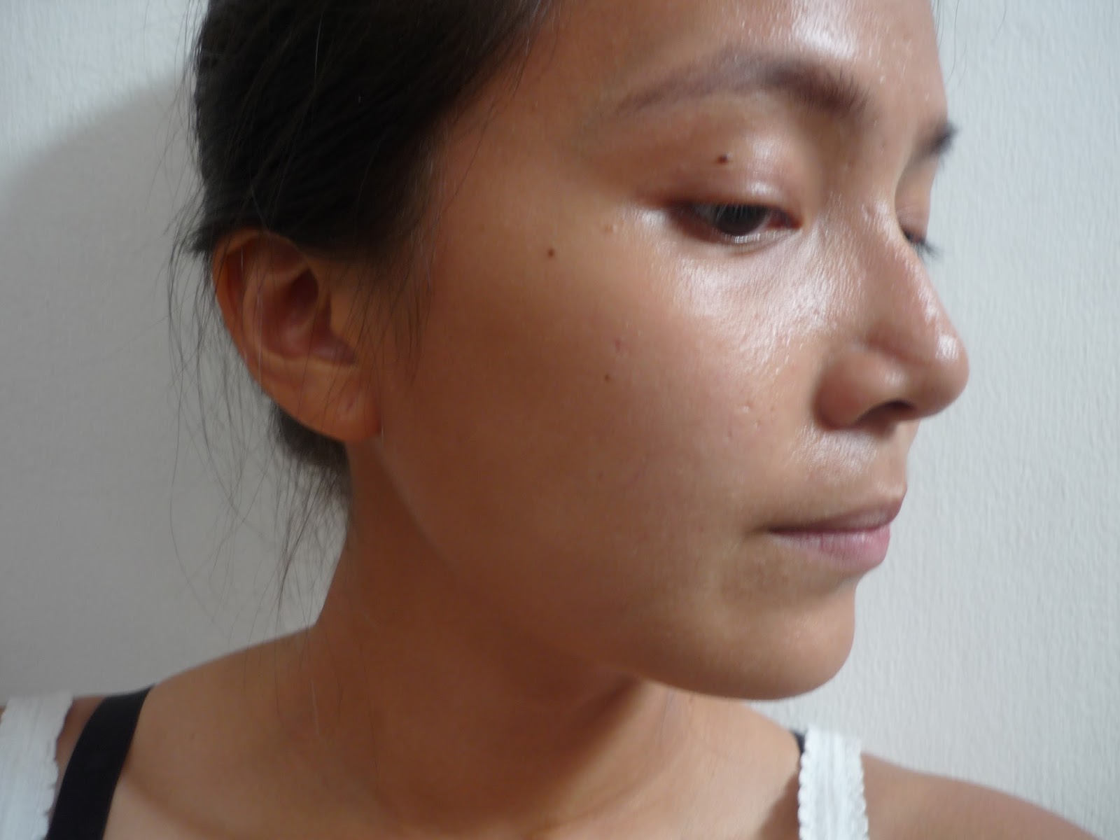 Accutane 10 Mg Online