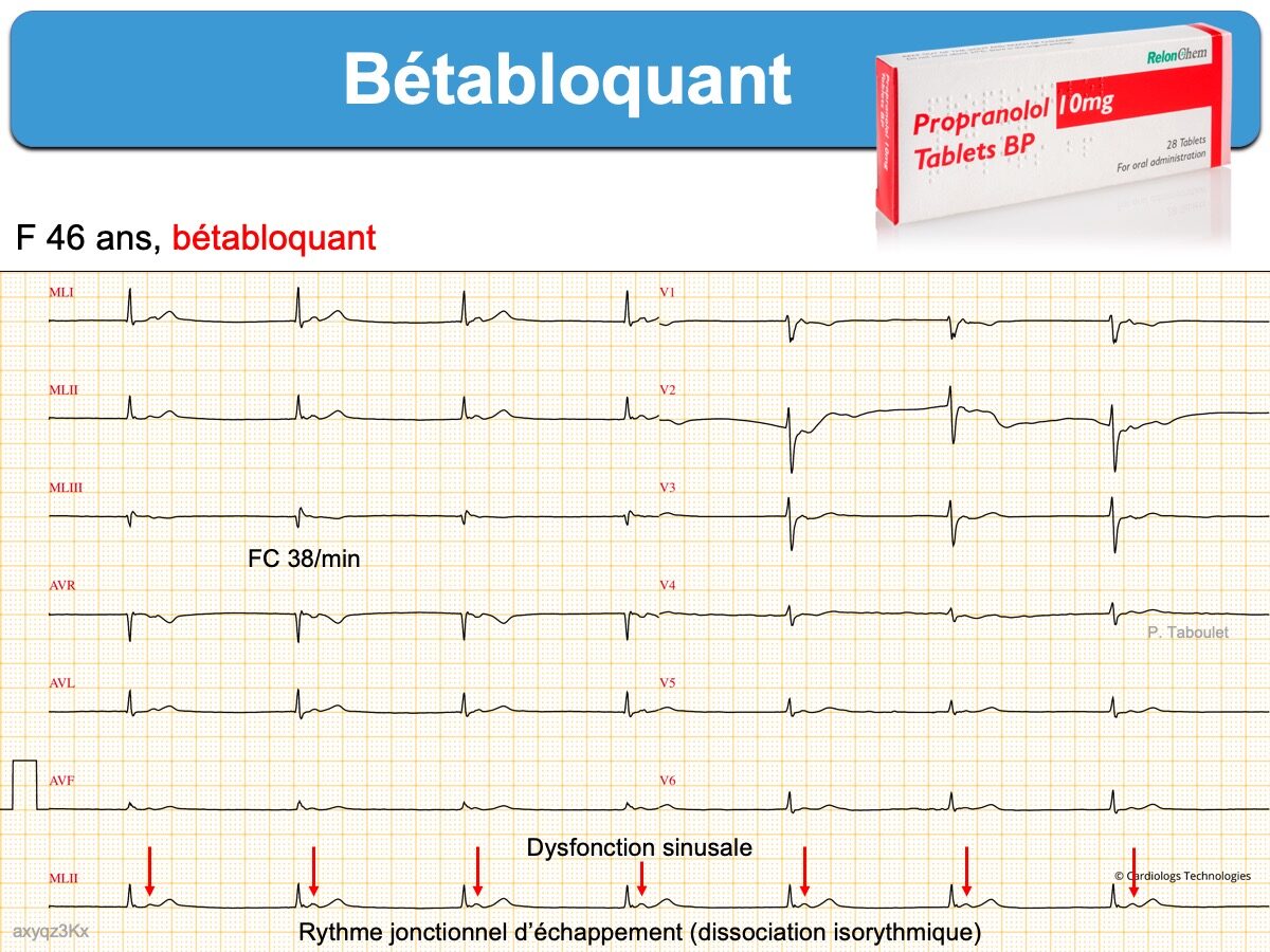 comment acheter du propranolol