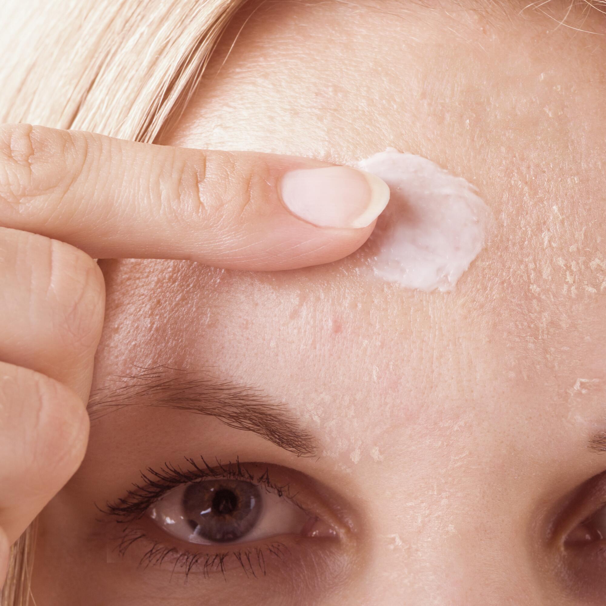 Roaccutane Acheter Online