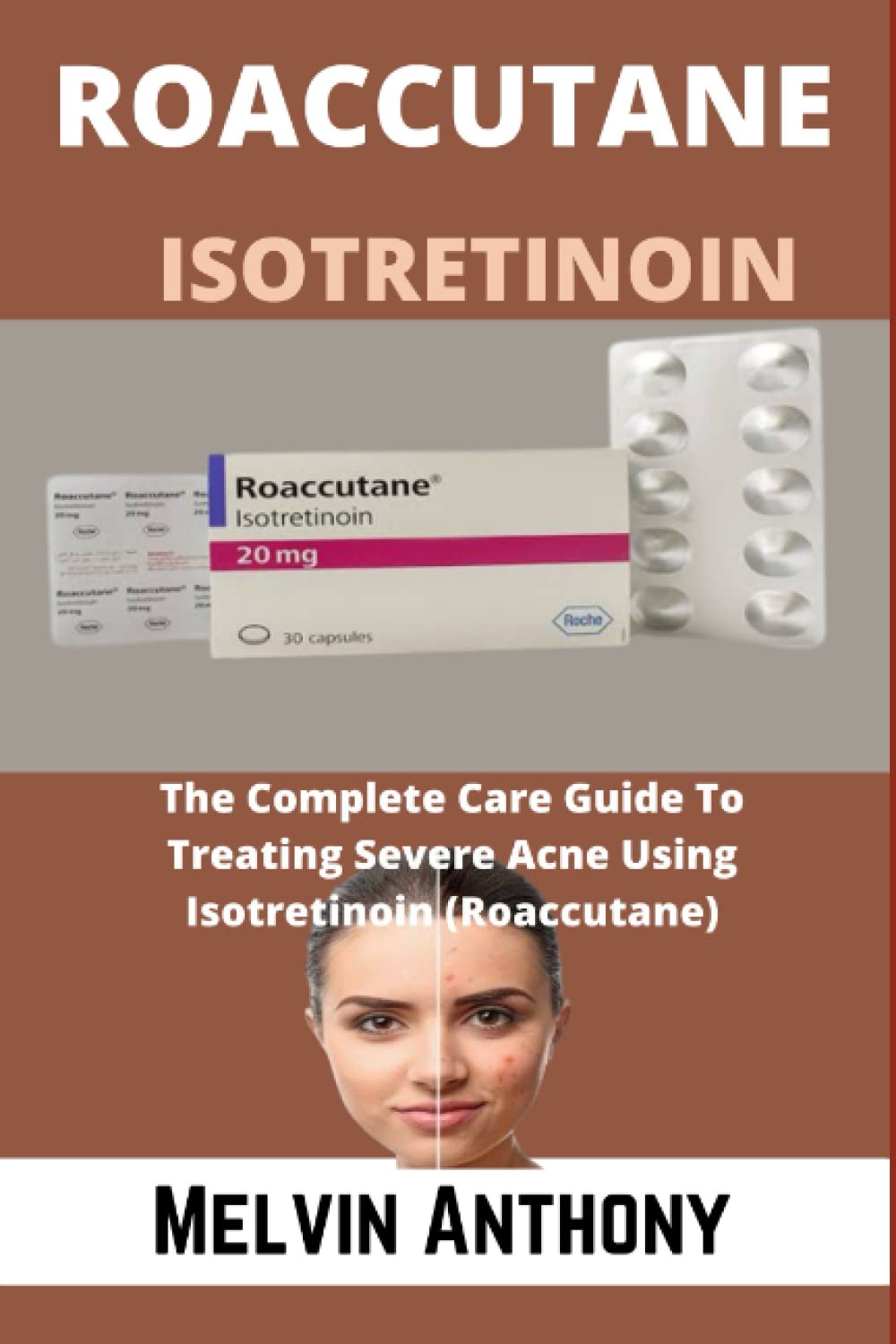 Roaccutane online
