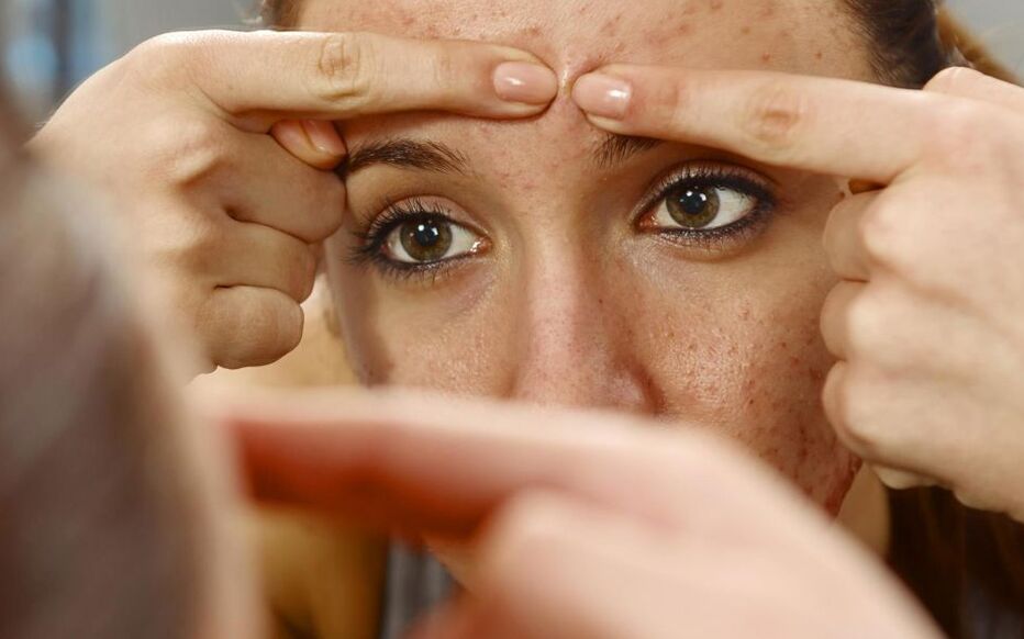 Pilule de roaccutane