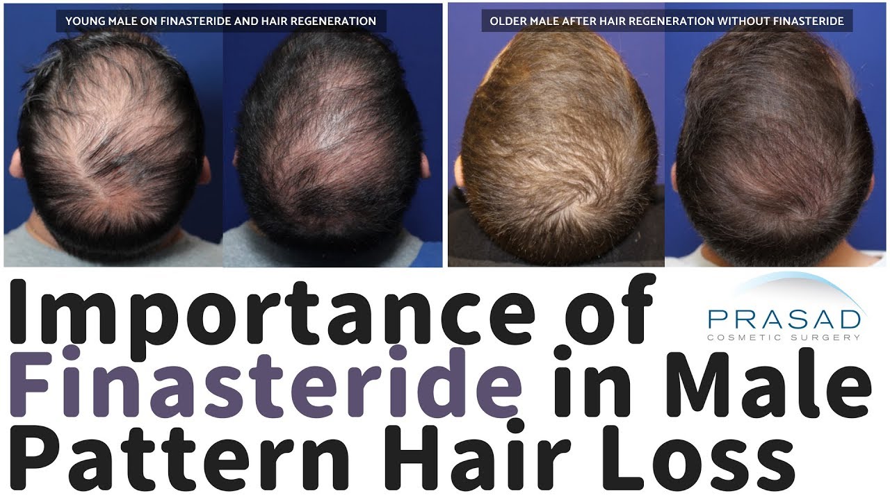 Commander finasteride