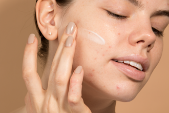 Roaccutane De 10 Mg