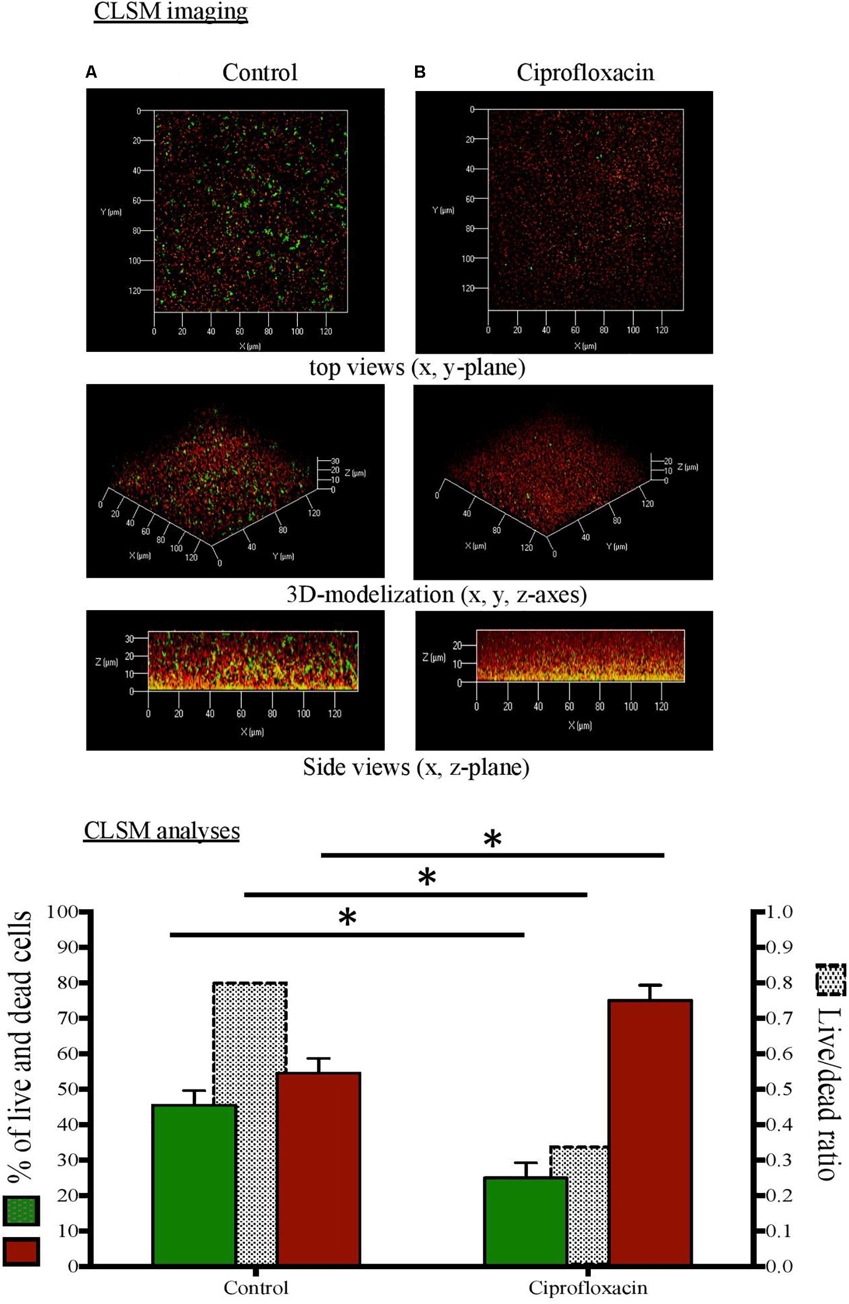 Ciprofloxacin en france