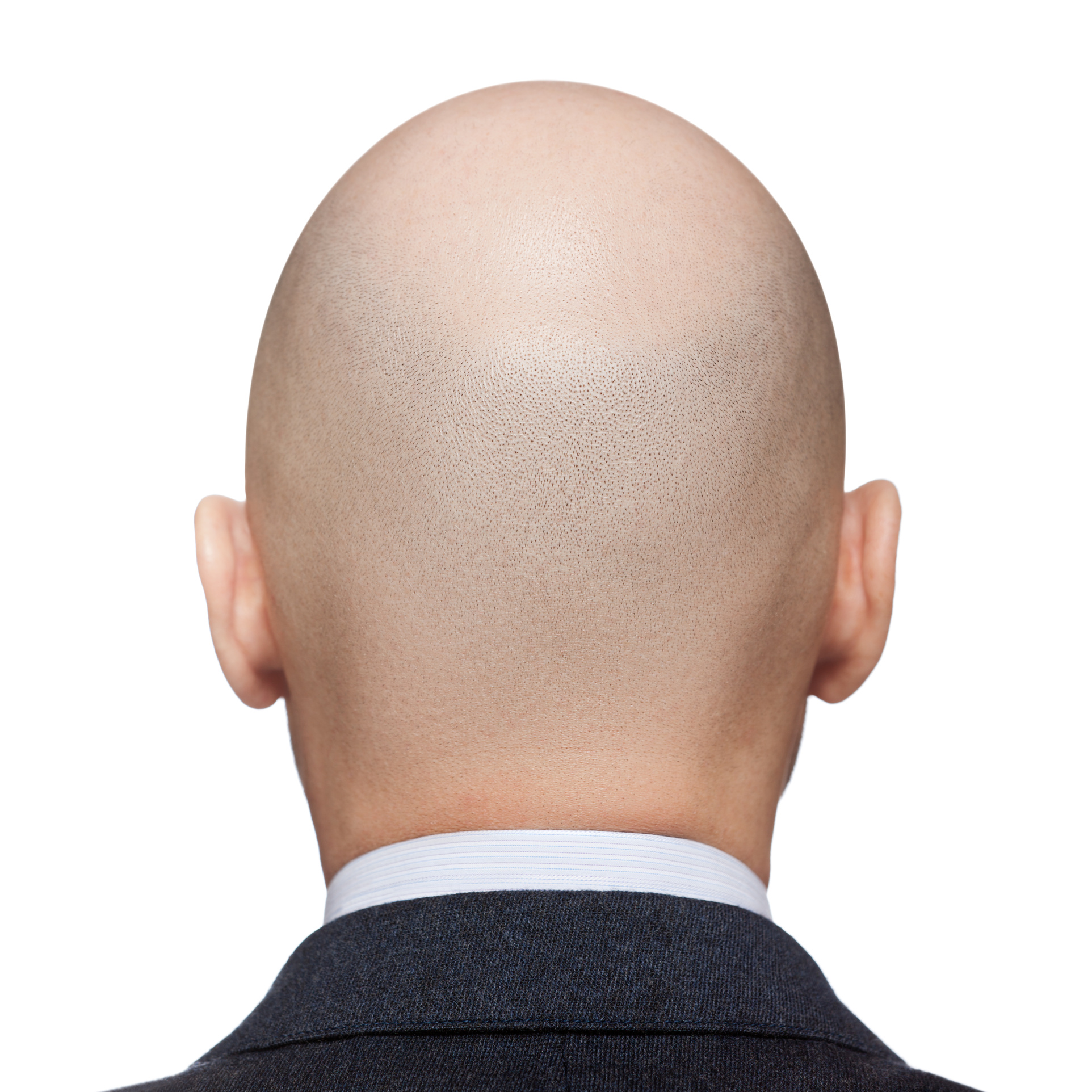 Propecia cheveux prix
