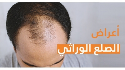 Finasteride 5mg cheveux prix
