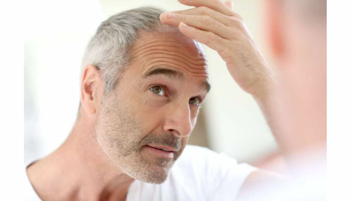finasteride bon marché