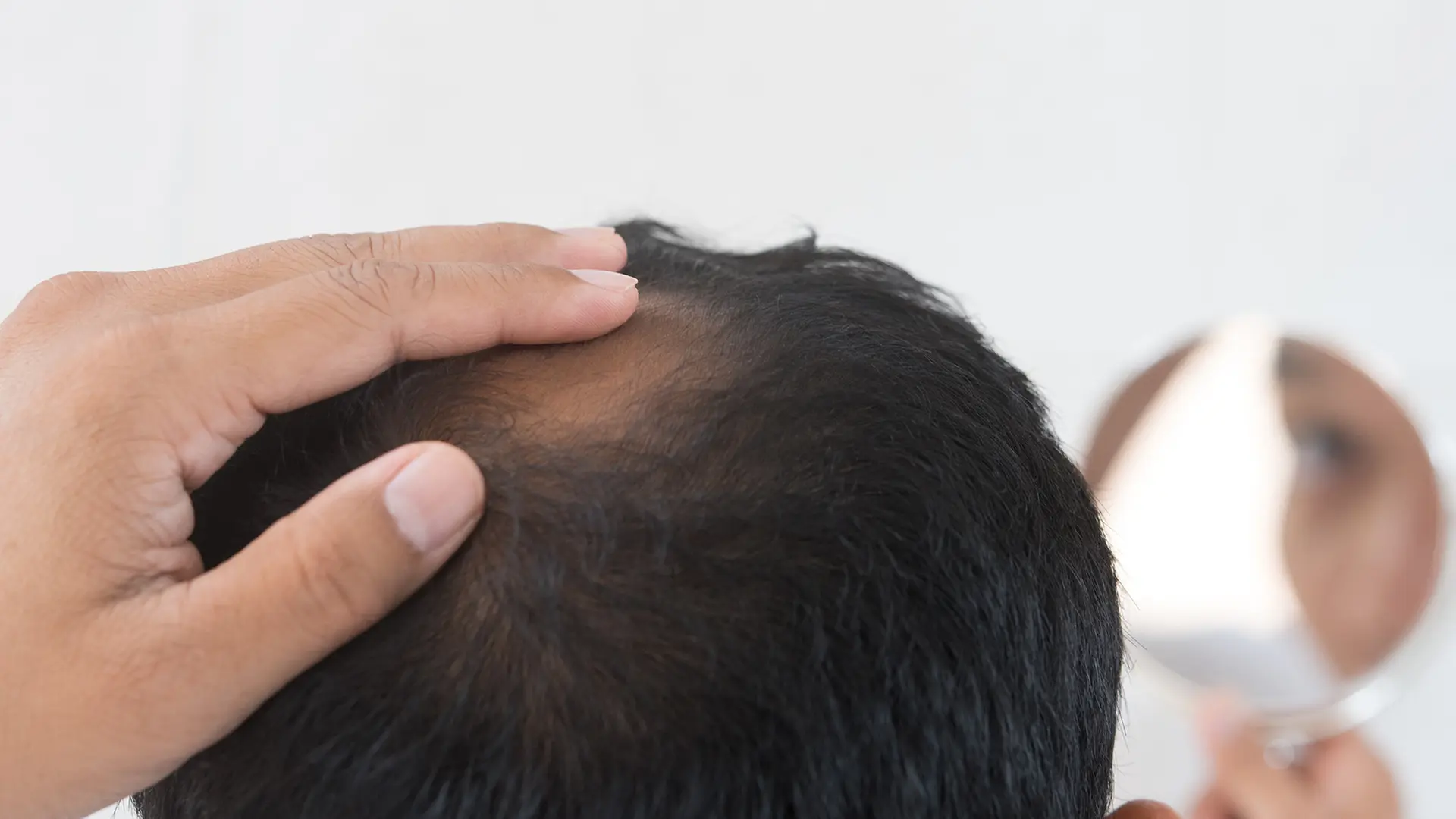 finasteride arrow 1 mg prix