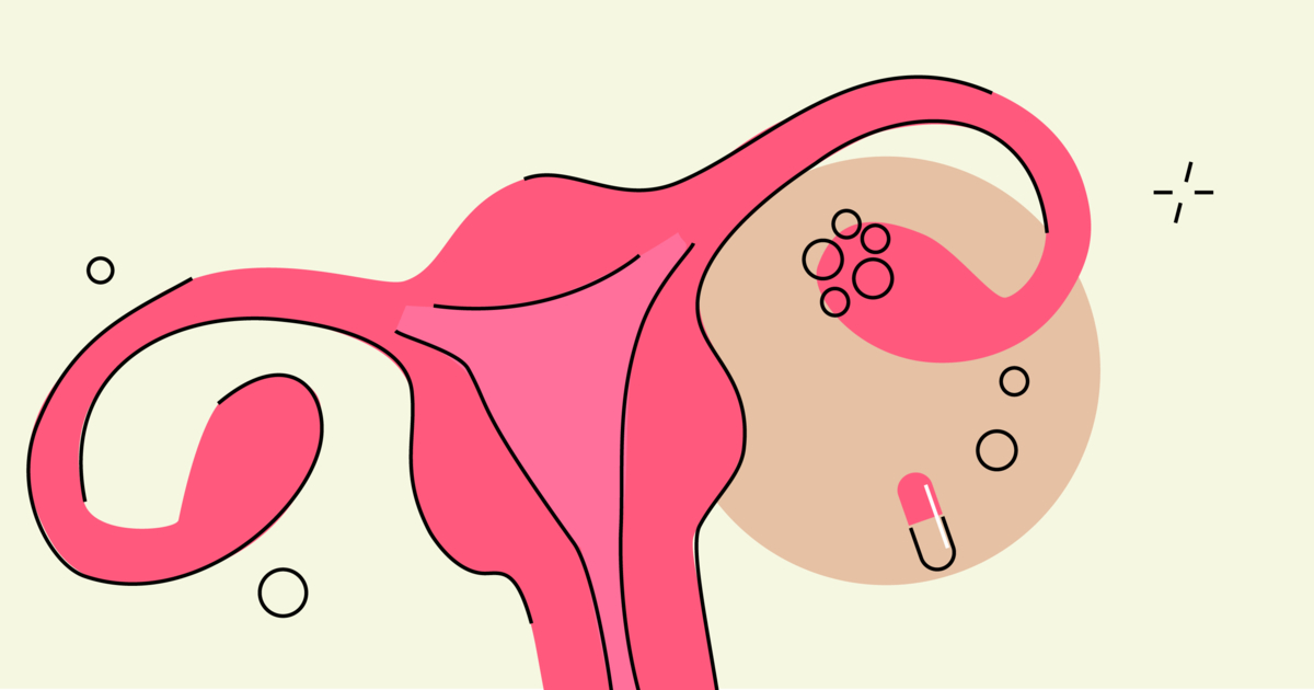 Metformin online pcos