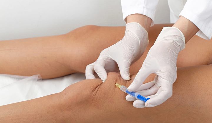 Achat Prednisolone En Ligne