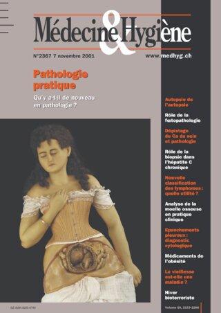 Coût du adipex