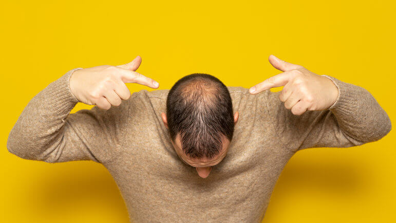Finasteride 1 Mg France