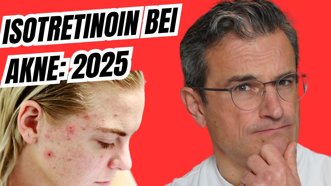 Online dermatologist isotretinoin