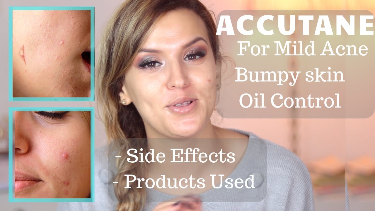 Accutane générique