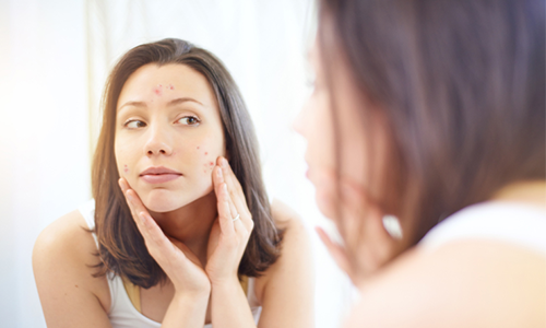 Roaccutane acheter ligne