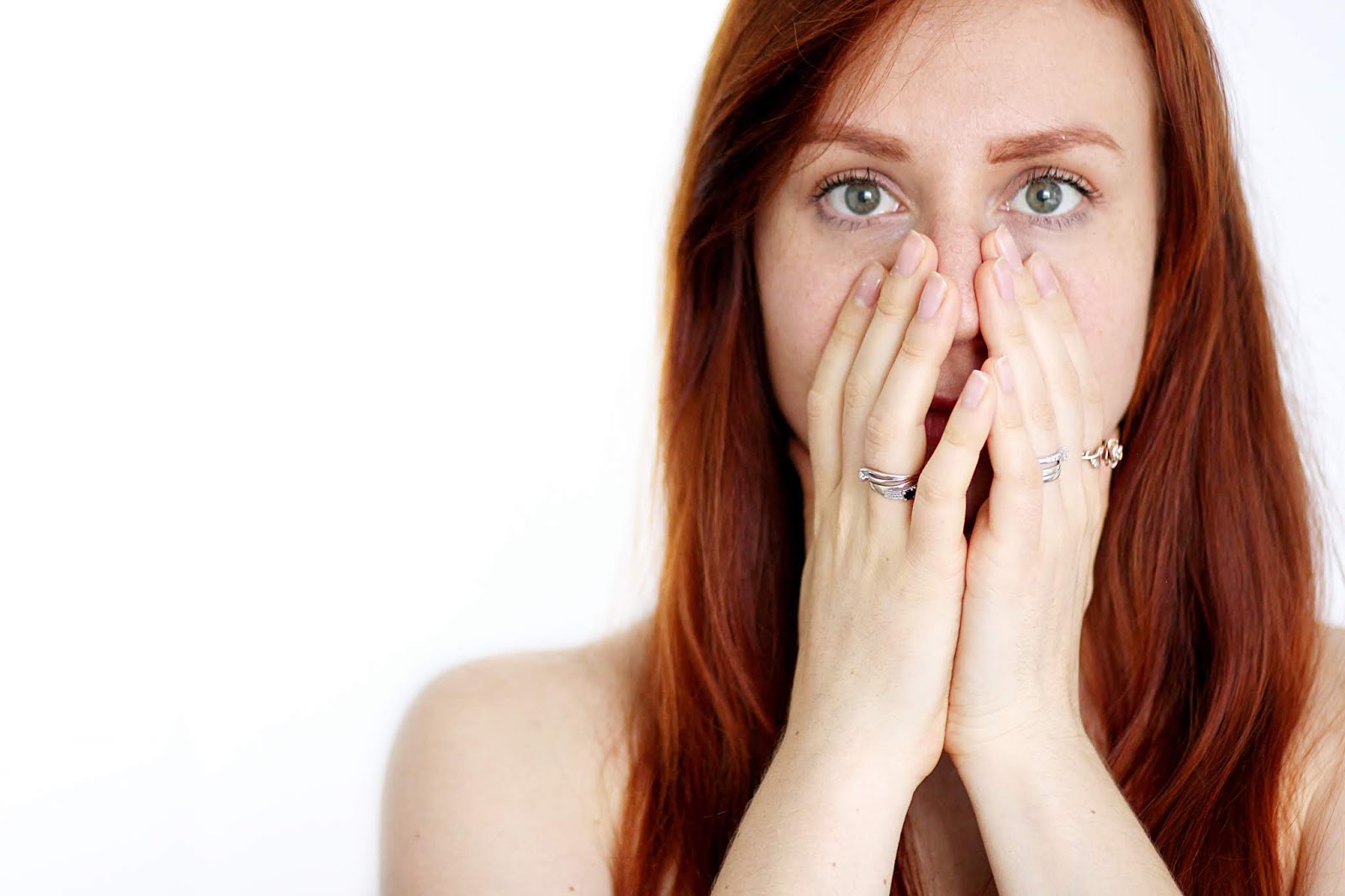 roaccutane apres arret pilule