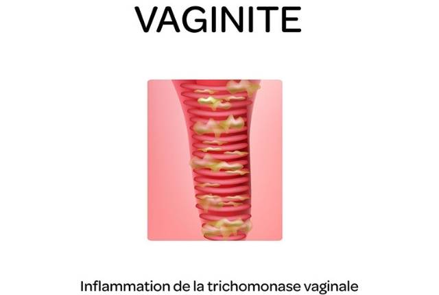 Prix Pour Oestrogènes Conjugués