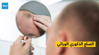 Prix Du Finasteride