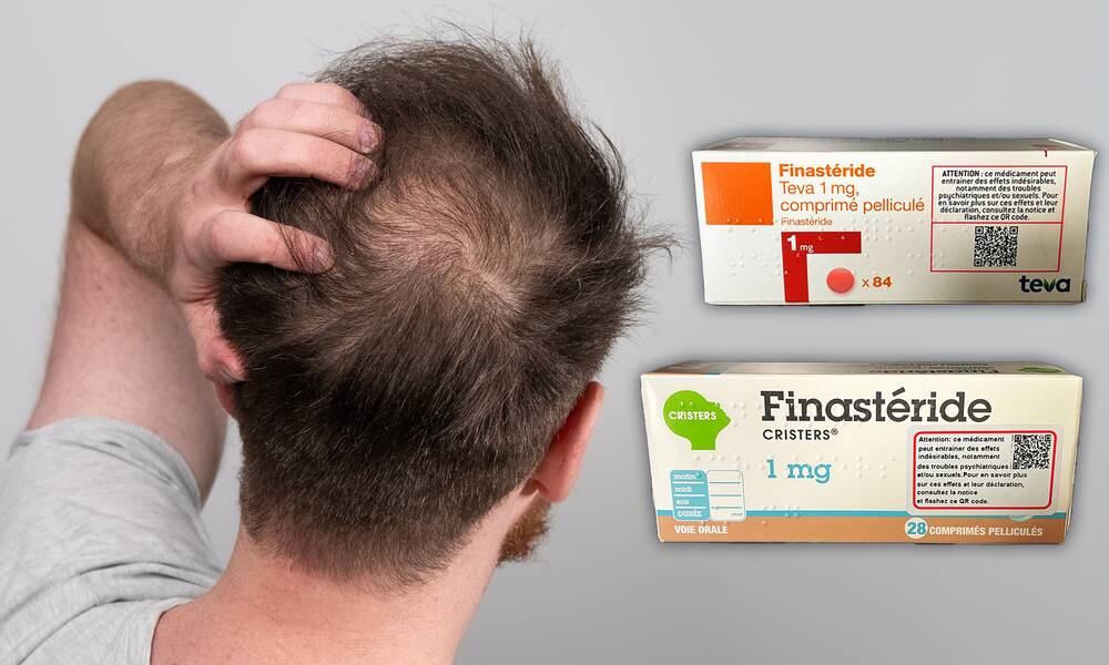 finasteride vente en ligne