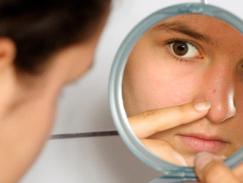 Interdiction accutane france