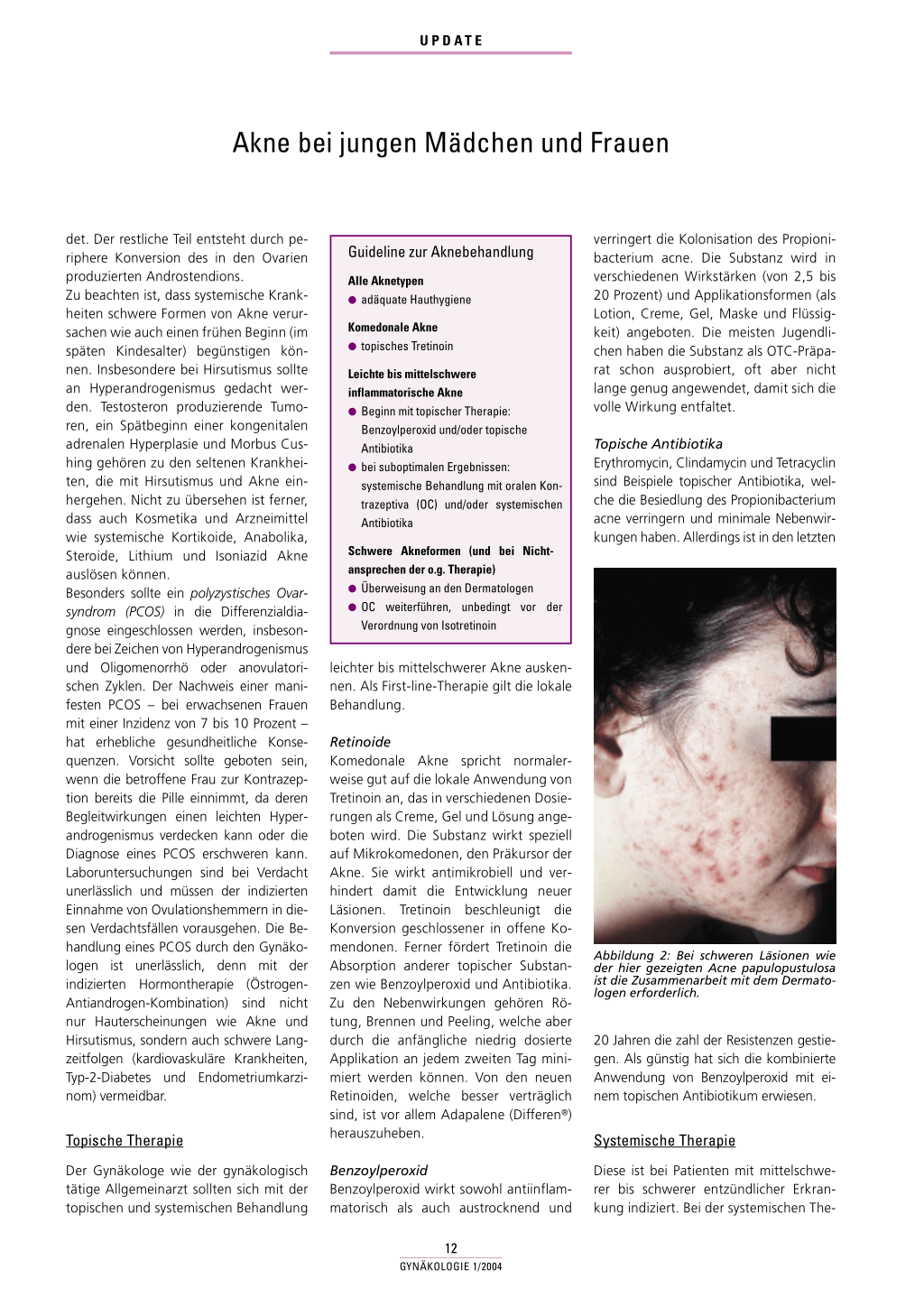 Prix De Roaccutane